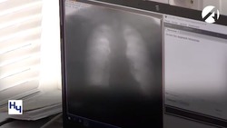 В астраханских муниципалитетах работает передвижной флюорограф