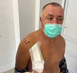 Астраханские врачи провели уникальную артроскопию плеча
