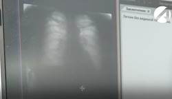 В Астрахани заработает передвижной флюорограф