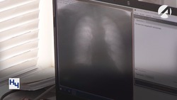 Астраханцы старше 15 лет смогут проверить здоровье в передвижном флюорографе