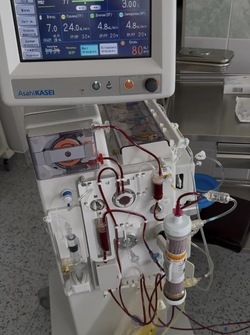 В борьбе с «плохим» холестерином астраханцам помогает инновационный метод