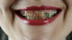 Стоматолога из Астрахани обманули на крупную сумму денег