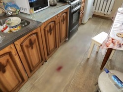 Астраханцу откусили ухо